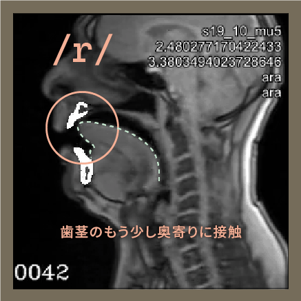 /r/の発音における舌の接触位置の図